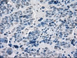 POR Antibody in Immunohistochemistry (Paraffin) (IHC (P))