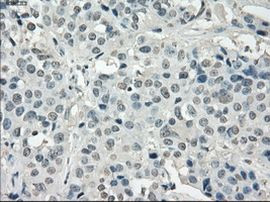 POR Antibody in Immunohistochemistry (Paraffin) (IHC (P))