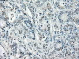 POR Antibody in Immunohistochemistry (Paraffin) (IHC (P))