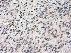 POR Antibody in Immunohistochemistry (Paraffin) (IHC (P))