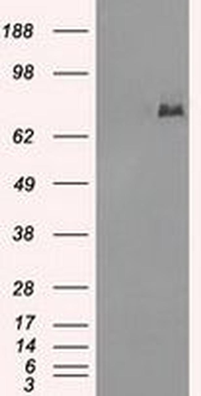 POR Antibody in Western Blot (WB)