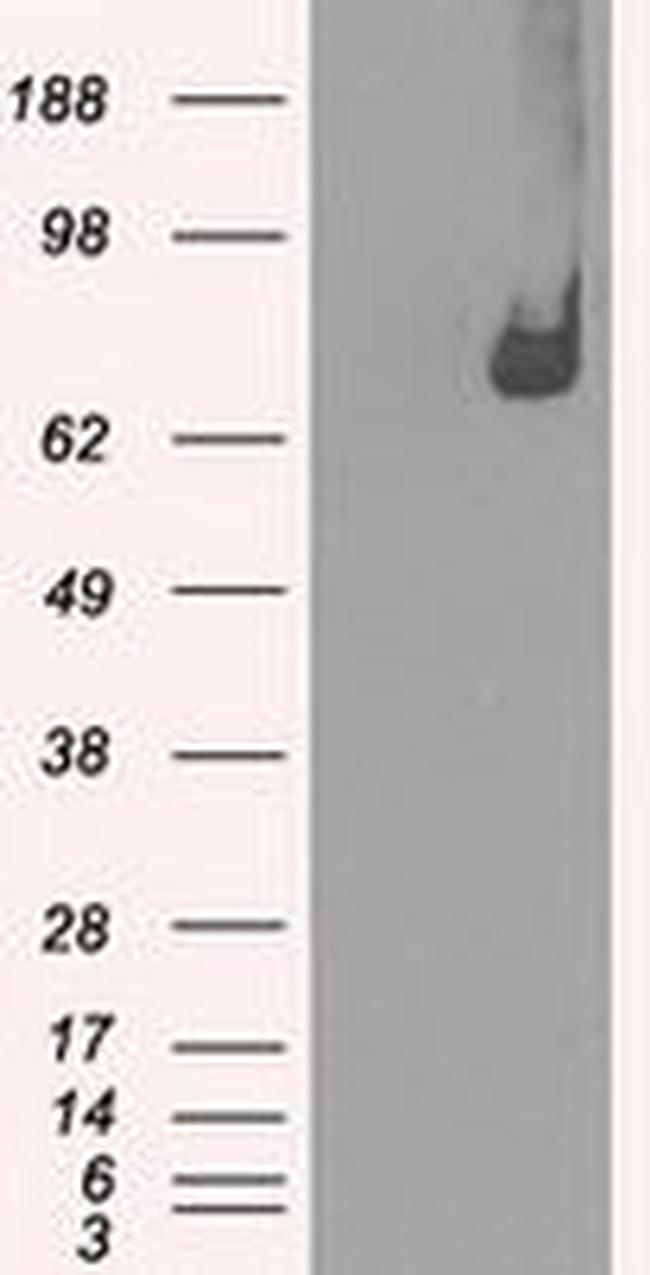 POR Antibody in Western Blot (WB)