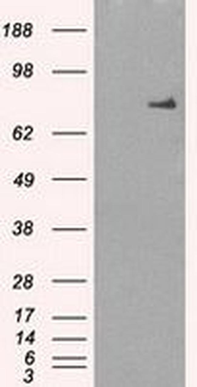 POR Antibody in Western Blot (WB)