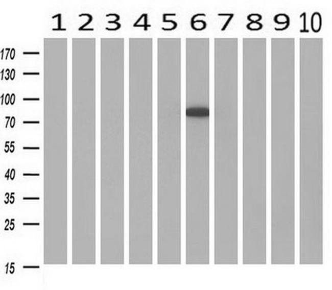 POR Antibody in Western Blot (WB)