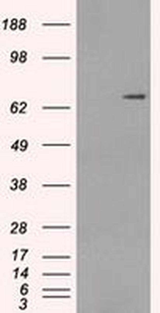 POR Antibody in Western Blot (WB)