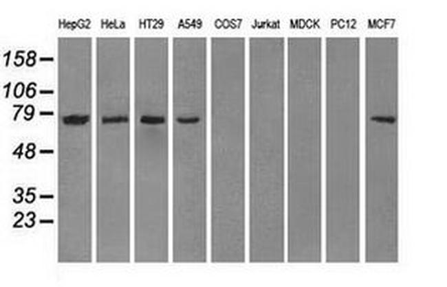 POR Antibody in Western Blot (WB)