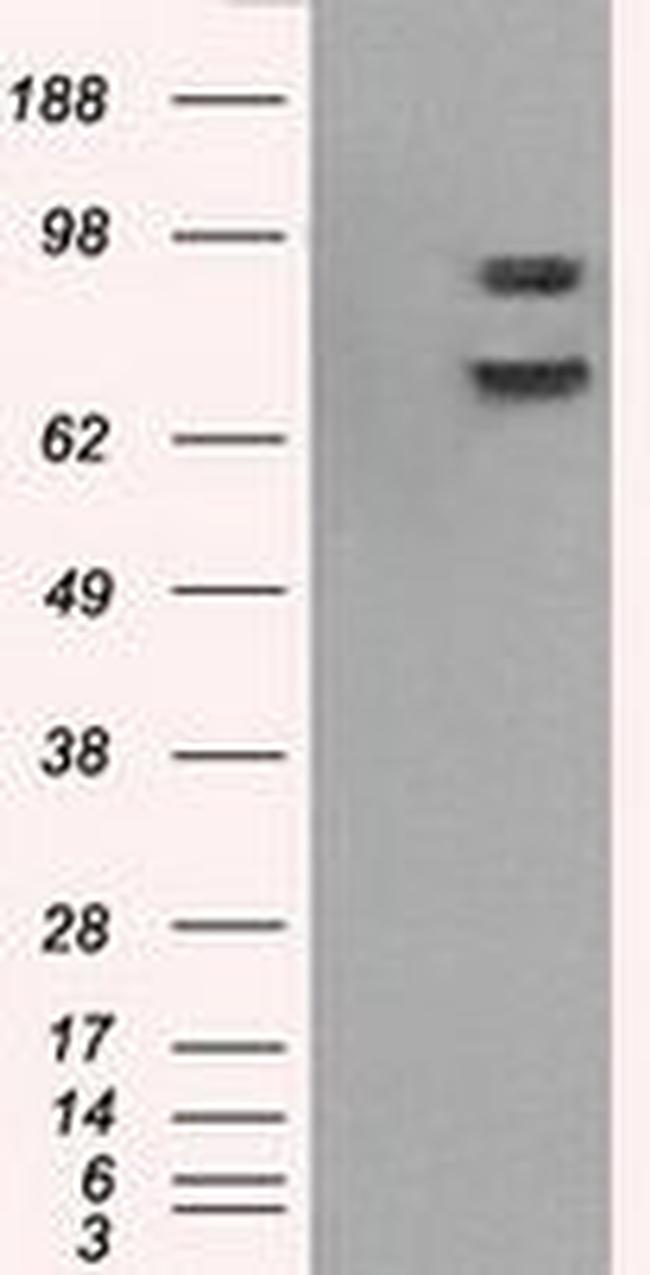 POR Antibody in Western Blot (WB)