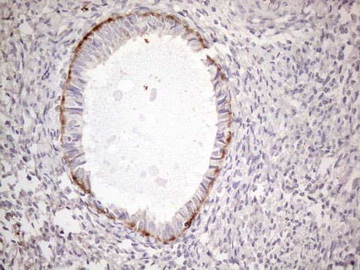 POTEG Antibody in Immunohistochemistry (Paraffin) (IHC (P))