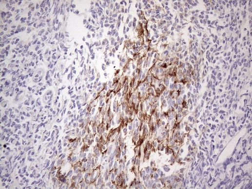 POTEG Antibody in Immunohistochemistry (Paraffin) (IHC (P))