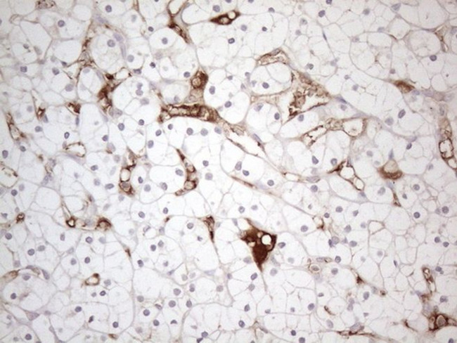 POTEG Antibody in Immunohistochemistry (Paraffin) (IHC (P))