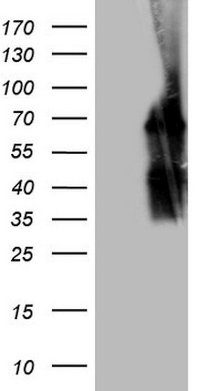 POTEG Antibody in Western Blot (WB)