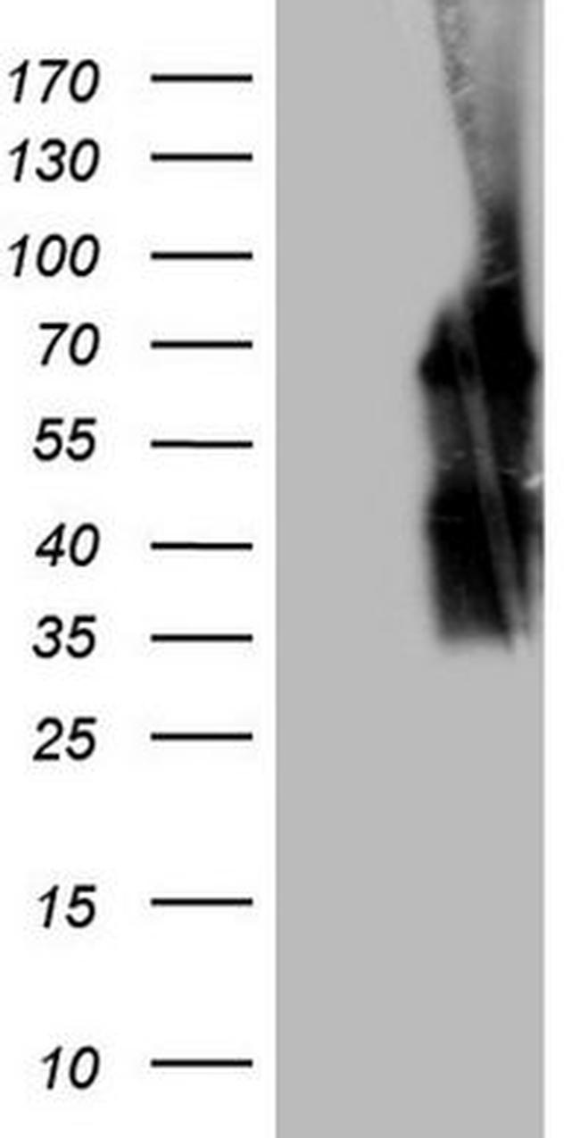 POTEG Antibody in Western Blot (WB)