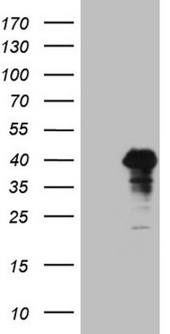 POU4F3 Antibody in Western Blot (WB)