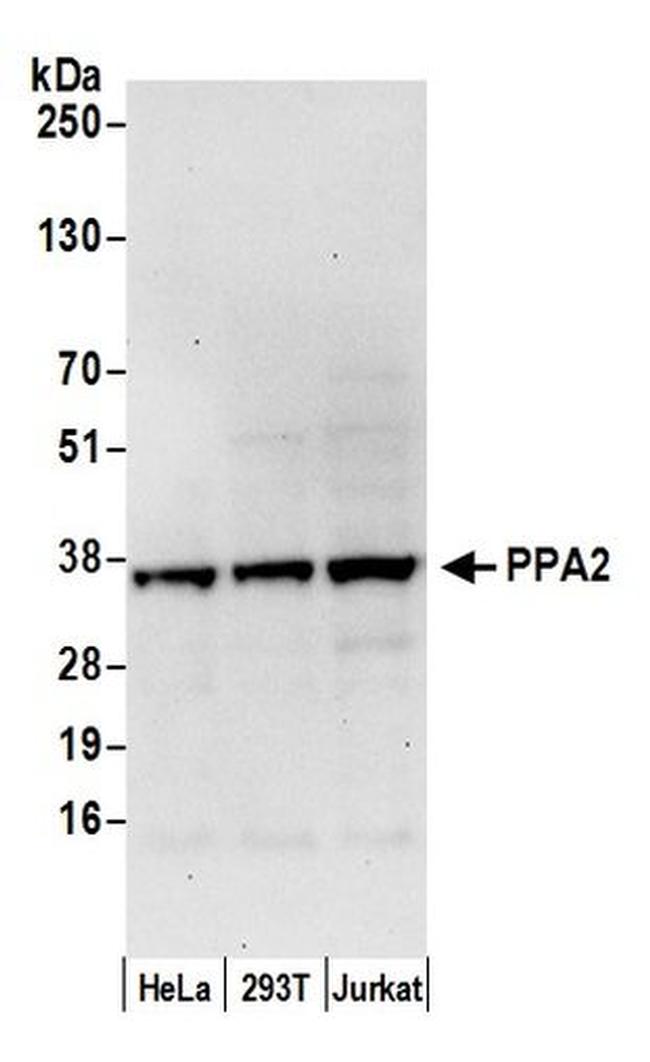 PPA2 Antibody in Western Blot (WB)