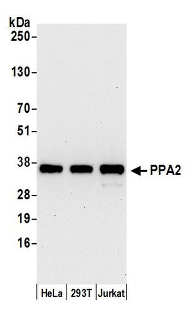 PPA2 Antibody in Western Blot (WB)