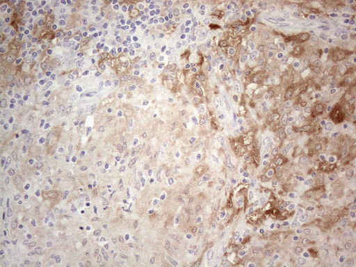 PPA2 Antibody in Immunohistochemistry (Paraffin) (IHC (P))