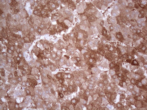 PPA2 Antibody in Immunohistochemistry (Paraffin) (IHC (P))