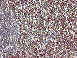 PPAP2A Antibody in Immunohistochemistry (Paraffin) (IHC (P))