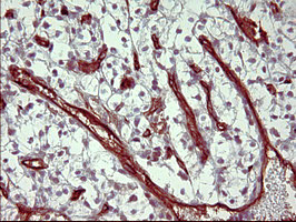 PPAP2A Antibody in Immunohistochemistry (Paraffin) (IHC (P))