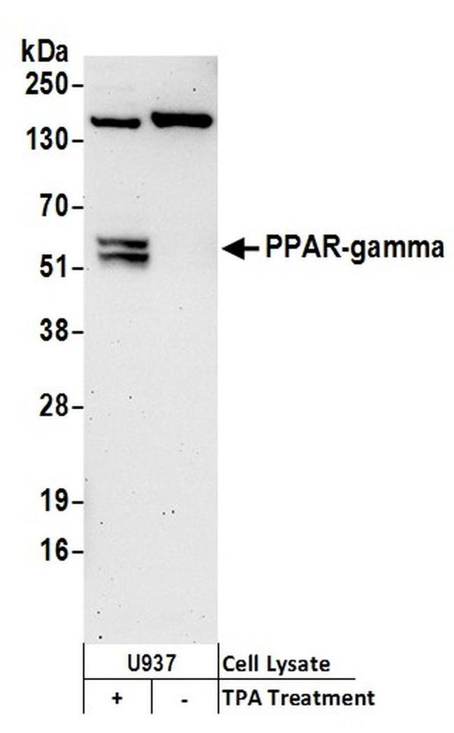 PPAR-gamma Antibody in Western Blot (WB)