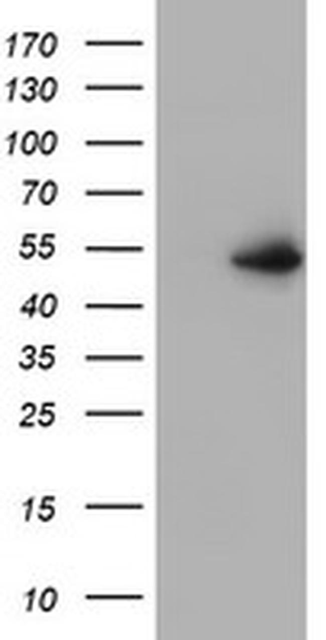 PPARA Antibody in Western Blot (WB)