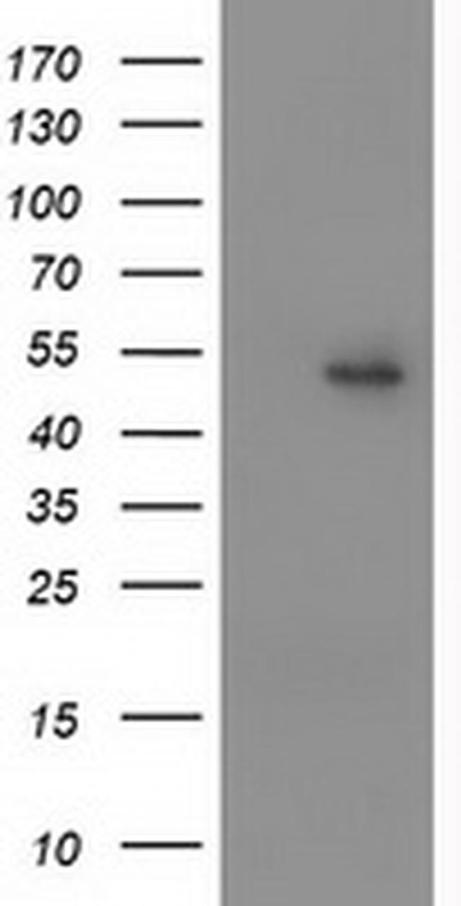 PPARA Antibody in Western Blot (WB)