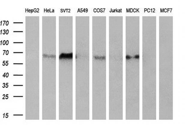 PPARA Antibody in Western Blot (WB)