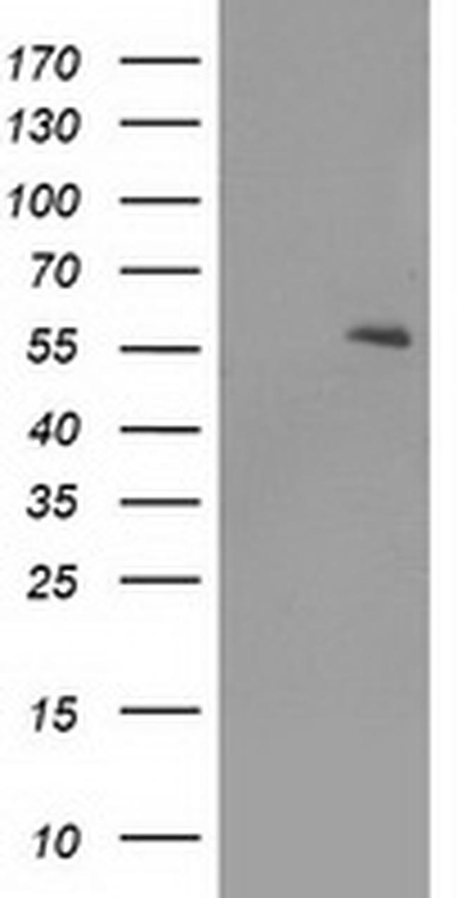 PPARA Antibody in Western Blot (WB)