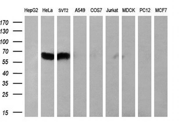 PPARA Antibody in Western Blot (WB)