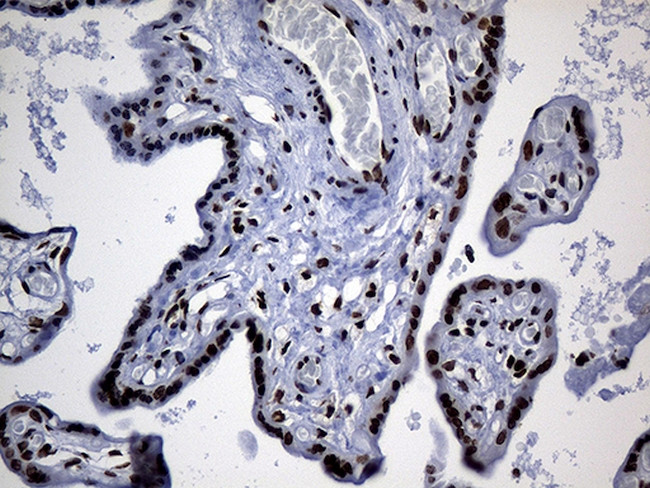 PPARD Antibody in Immunohistochemistry (Paraffin) (IHC (P))