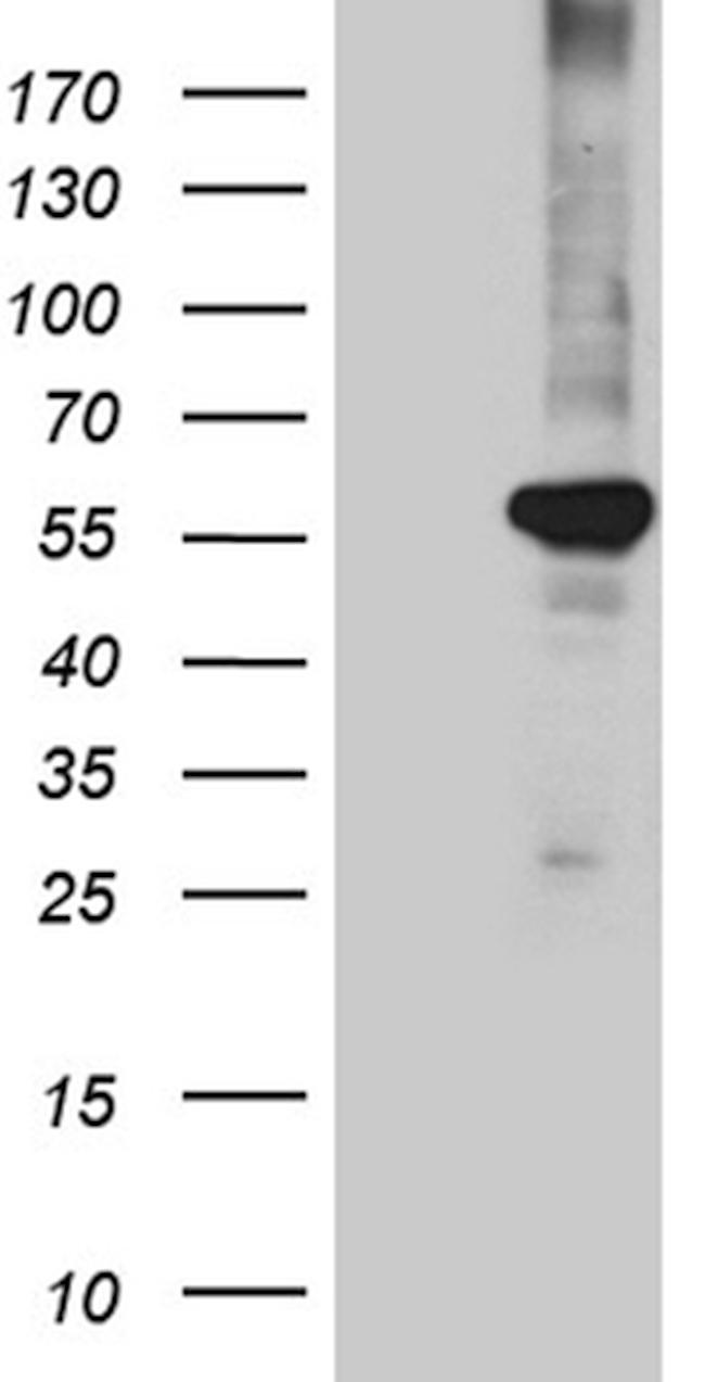 PPARD Antibody in Western Blot (WB)