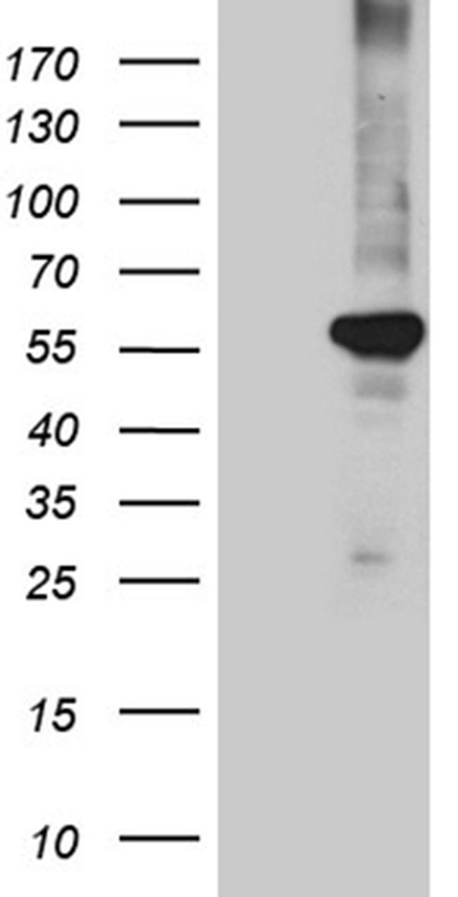 PPARD Antibody in Western Blot (WB)