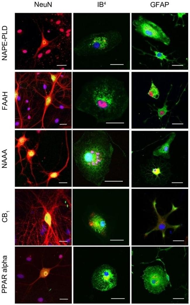 PPAR alpha Antibody in Immunocytochemistry (ICC/IF)