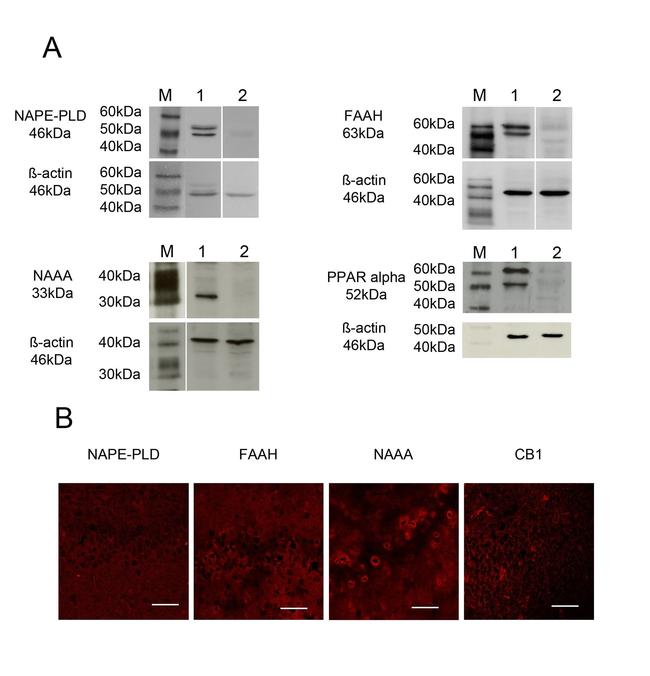 PPAR alpha Antibody in Western Blot (WB)