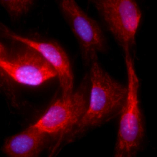 PPAR gamma-2 Antibody in Immunocytochemistry (ICC/IF)