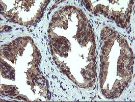 PPAT Antibody in Immunohistochemistry (Paraffin) (IHC (P))