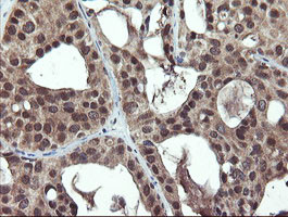 PPAT Antibody in Immunohistochemistry (Paraffin) (IHC (P))