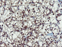 PPAT Antibody in Immunohistochemistry (Paraffin) (IHC (P))