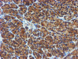 PPAT Antibody in Immunohistochemistry (Paraffin) (IHC (P))