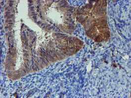 PPAT Antibody in Immunohistochemistry (Paraffin) (IHC (P))