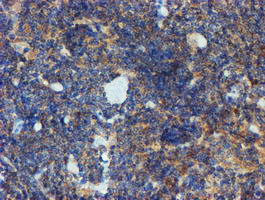 PPAT Antibody in Immunohistochemistry (Paraffin) (IHC (P))