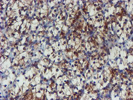 PPAT Antibody in Immunohistochemistry (Paraffin) (IHC (P))