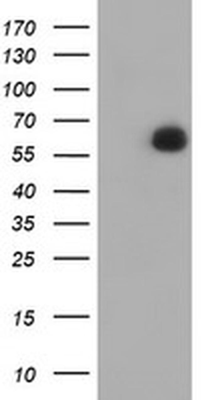 PPAT Antibody in Western Blot (WB)