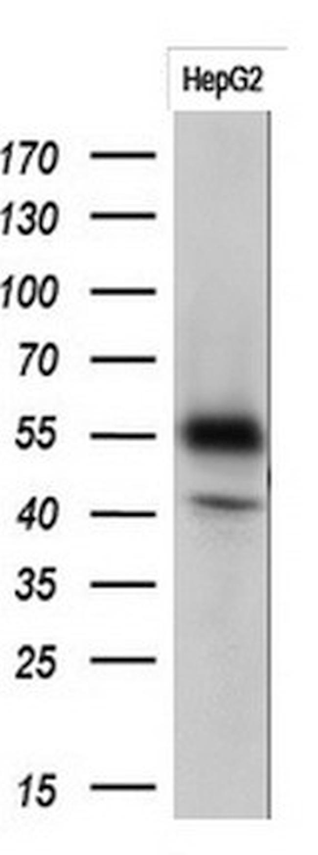 PPAT Antibody in Western Blot (WB)