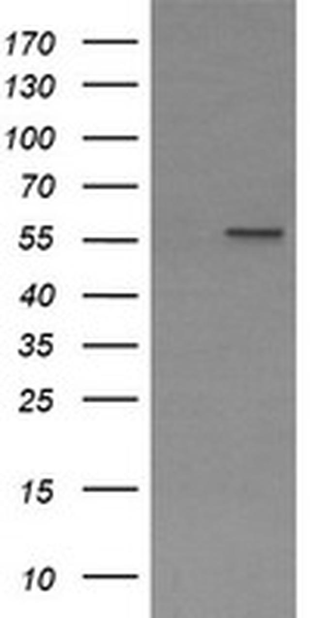 PPAT Antibody in Western Blot (WB)