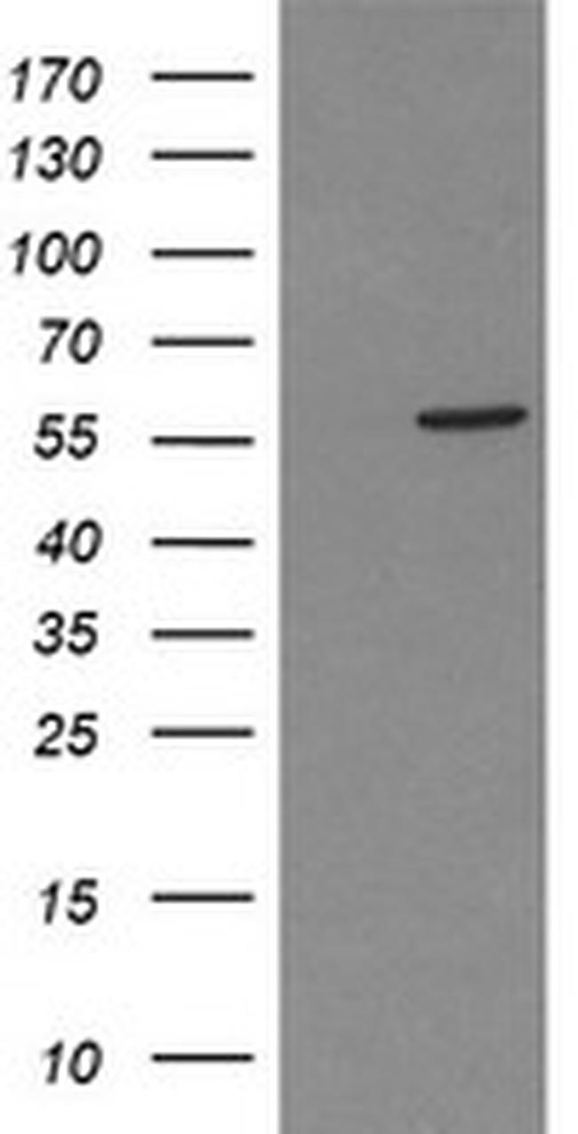 PPAT Antibody in Western Blot (WB)