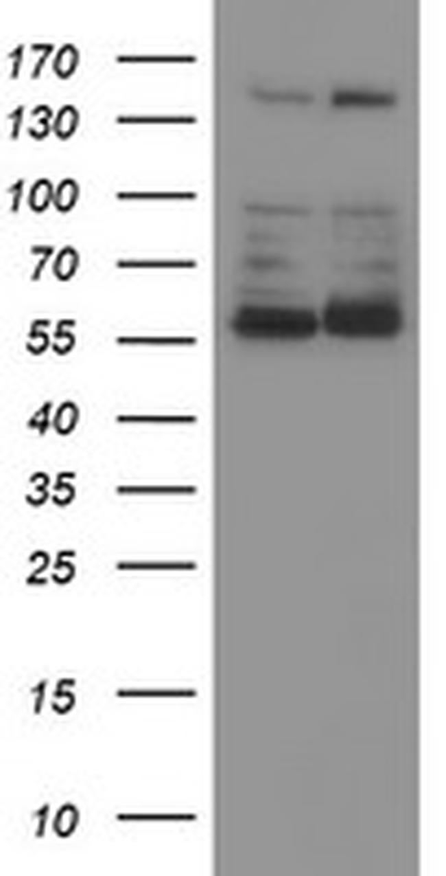 PPAT Antibody in Western Blot (WB)