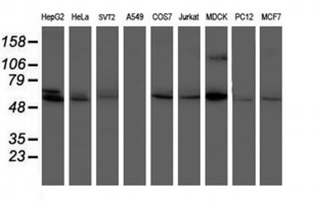 PPAT Antibody in Western Blot (WB)