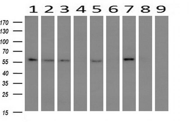 PPAT Antibody in Western Blot (WB)