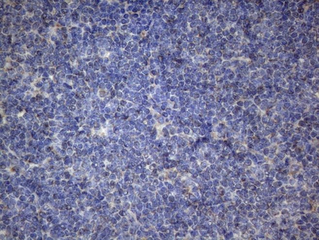 PPIF Antibody in Immunohistochemistry (Paraffin) (IHC (P))